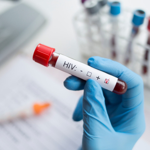Besplatna testiranja na polno prenosive bolesti: "Ne treba da se plašimo HIV-a, nego neznanja" VIDEO