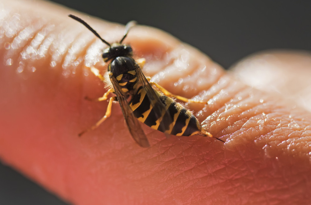Spas kod ujeda ose, pčele ili stršljena: Stavite ovo na mesto uboda, nestaće i bol i otok