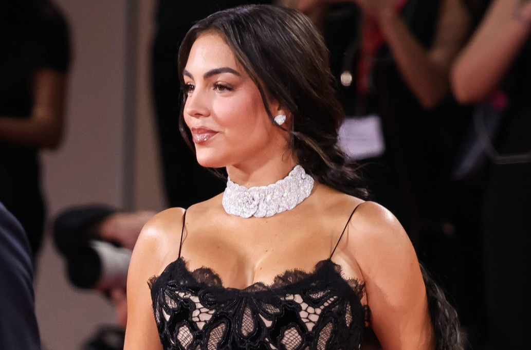 Dijamantski prsten ili bujne grudi – ne zna se šta je veće FOTO