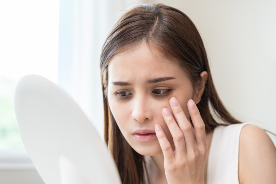 Podočnjaci nakon praznika: 7 prirodnih i brzih rešenja da ih uklonite