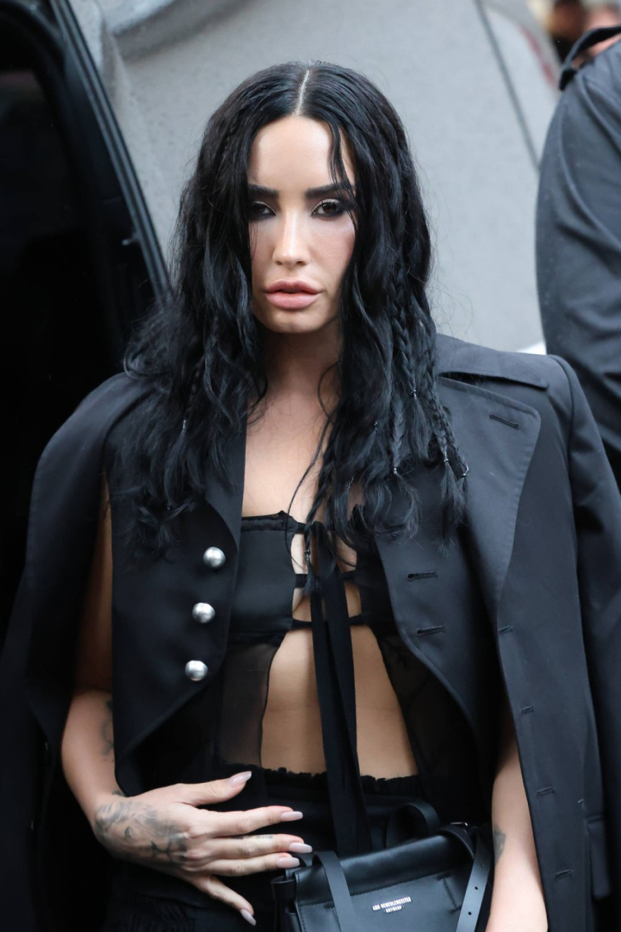 Uhapsite njenog plastičnog hirurga: Pevačica iznenadila ispeglanim licem FOTO