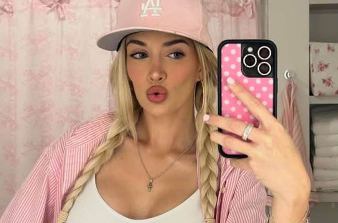 Ćerka Čarlija Šina objavila "pre i posle" fotku: "Hvala Bogu na plastičnim operacijama" FOTO