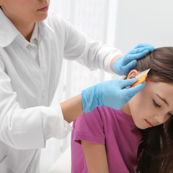 "Deca imaju rane na glavi": Problem sa vaškama u Beogradu, oglasio se Gradski zavod za javno zdravlje