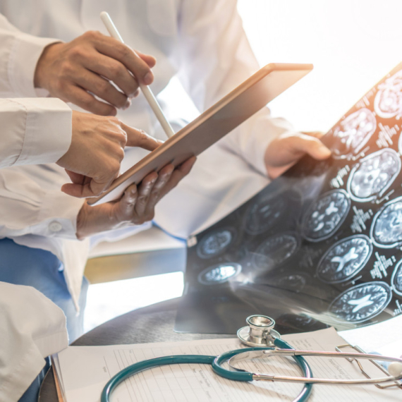 Revolucionarna terapija u lečenju moždanog udara