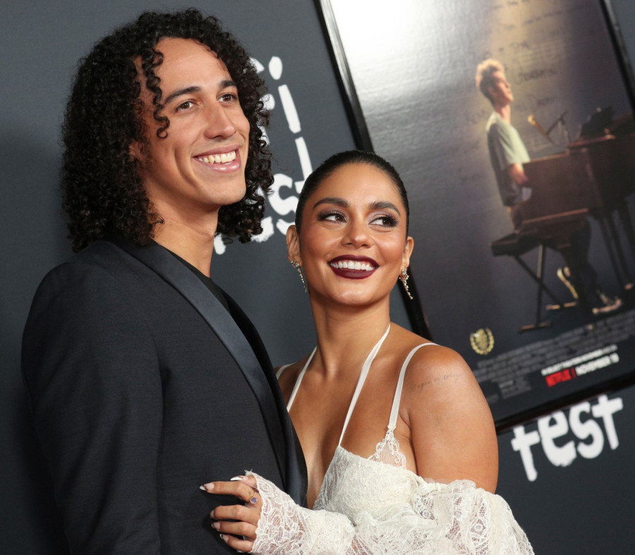 Glumica pokazala iznenadni gubitak kose, pa sve šokirala: Počelo je FOTO