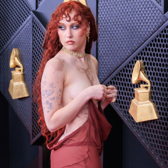 Sećate se dame sa golim grudima na dodeli Gremi nagrada: E, sad se oglasila FOTO