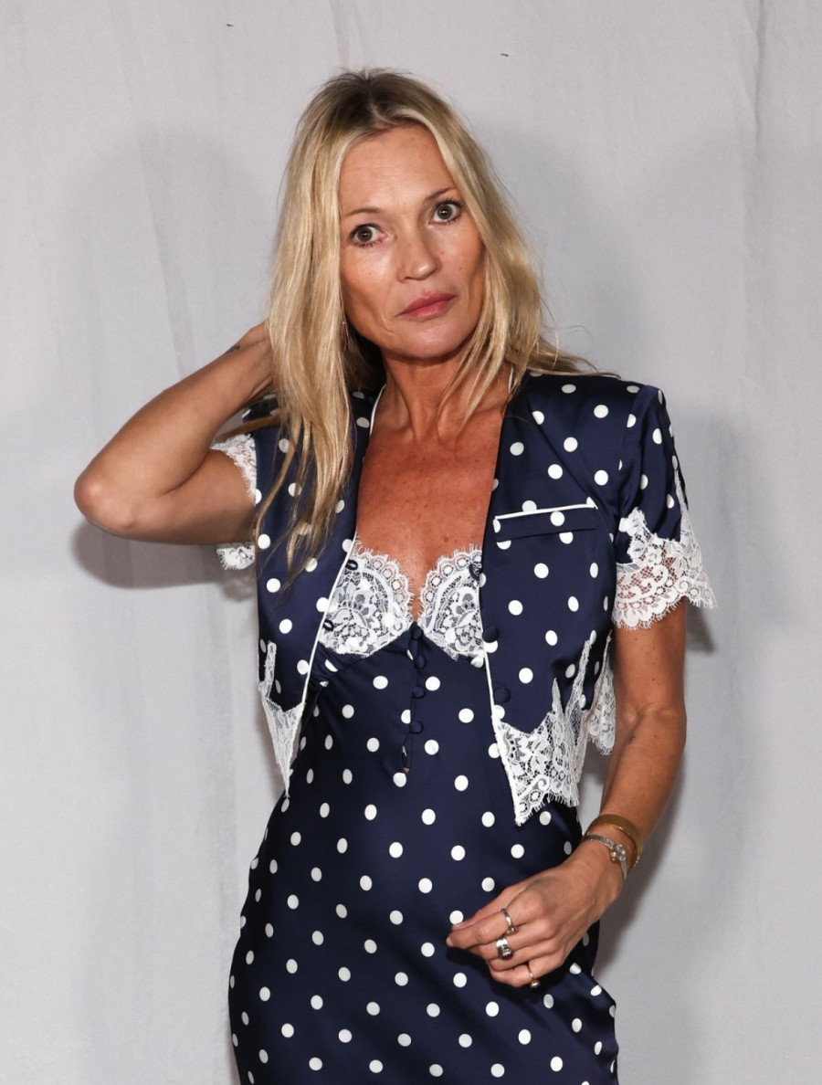 Lepša nego ikad: Seks-bomba devedesetih ima novo lice i svima se dopada FOTO