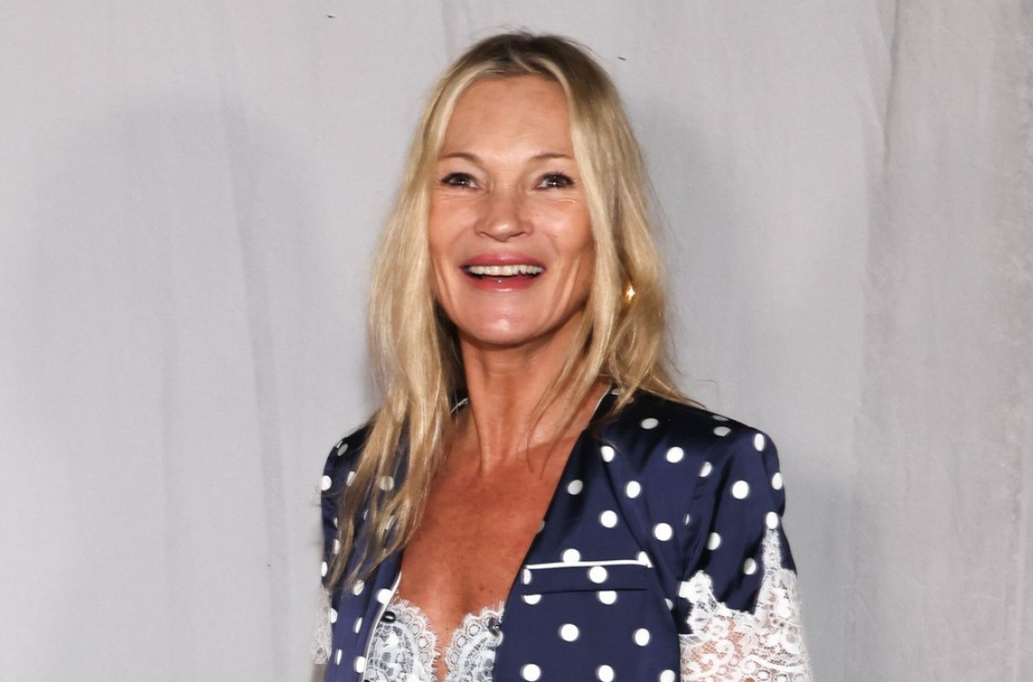 Lepša nego ikad: Seks-bomba devedesetih ima novo lice i svima se dopada FOTO