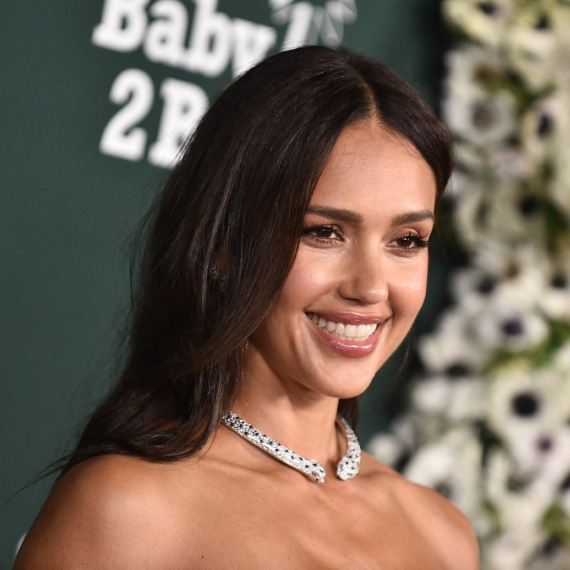 Drastična promena imidža jedne od najpoželjnijih glumica: Ludo zaljubljena i nikad lepša FOTO