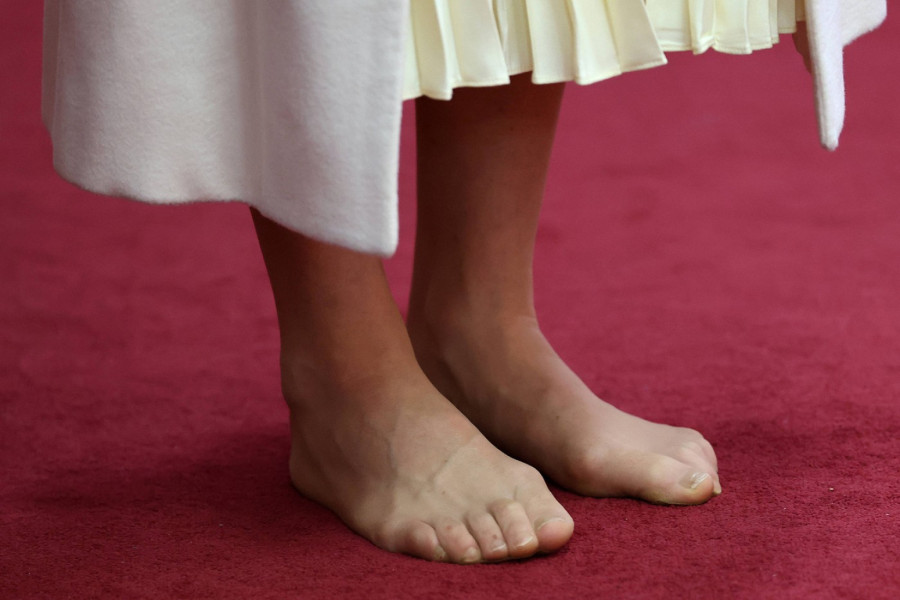 Stopala Kejt Midlton zgrozila javnost: Mogla je bar nokte da iseče FOTO