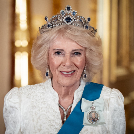 I kraljica Kamila ima "novo lice": Popularni tretman platila 1.700 evra FOTO