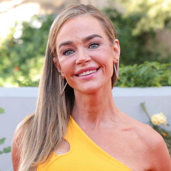 Deniz Ričards pre i posle operacija: Objavila je slike i pokazala drastičnu promenu FOTO