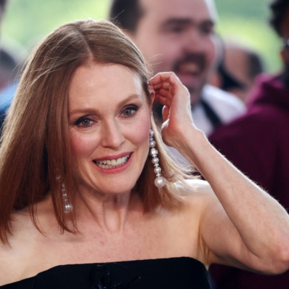 "Zvali su me jagoda sa pegicama, ali nikad ništa nisam radila na licu" FOTO