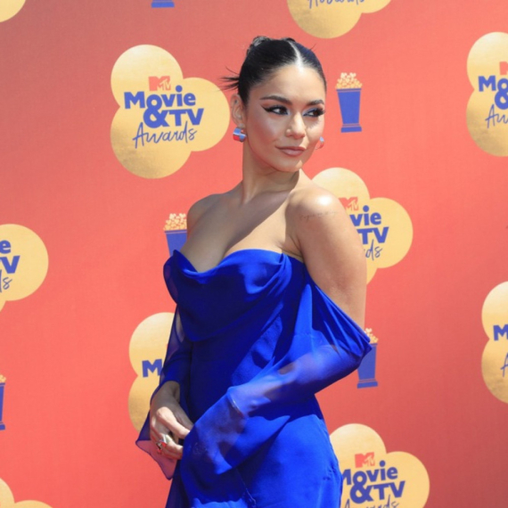 Glumica pokazala iznenadni gubitak kose, pa sve šokirala: "Počelo je" FOTO