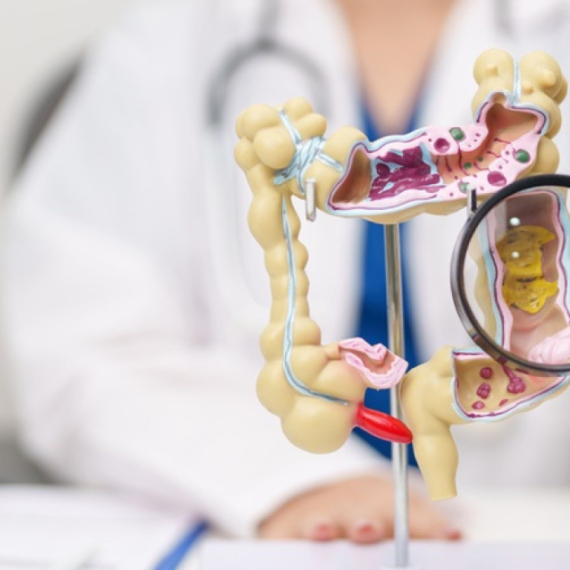 Sve veći porast raka debelog creva kod mladih: "Niko nije premlad za ovu dijagnozu"