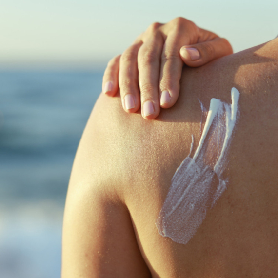 Krema ili sprej za sunčanje? Dermatolozi otkrili šta je bolji izbor