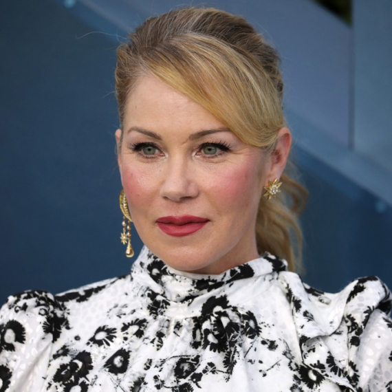 Glumica godinama verovala da ima multiplu sklerozu: Kristina Eplgejt saznala surovu istinu
