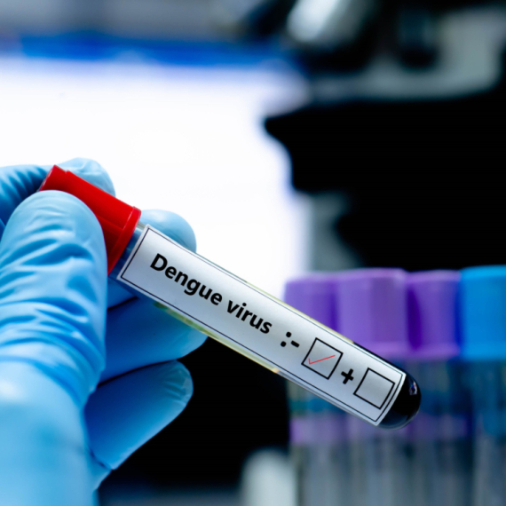 Lekari upozoravaju: Epidemija se ne smiruje, 173 smrtna slučaja u oktobru